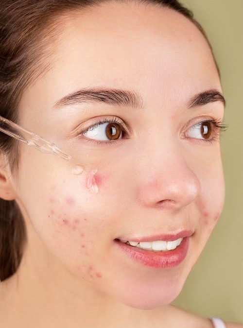 5 Common Beauty Treatments in Los Angeles for Sun-Damaged Skin