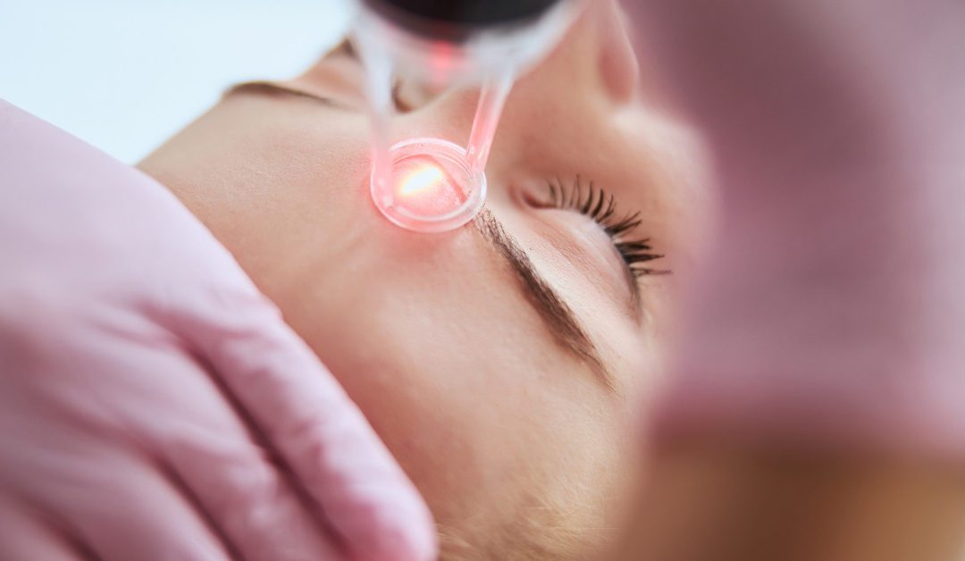 What Does Your Face Look Like After Skin Laser Resurfacing in Los Angeles, CA?